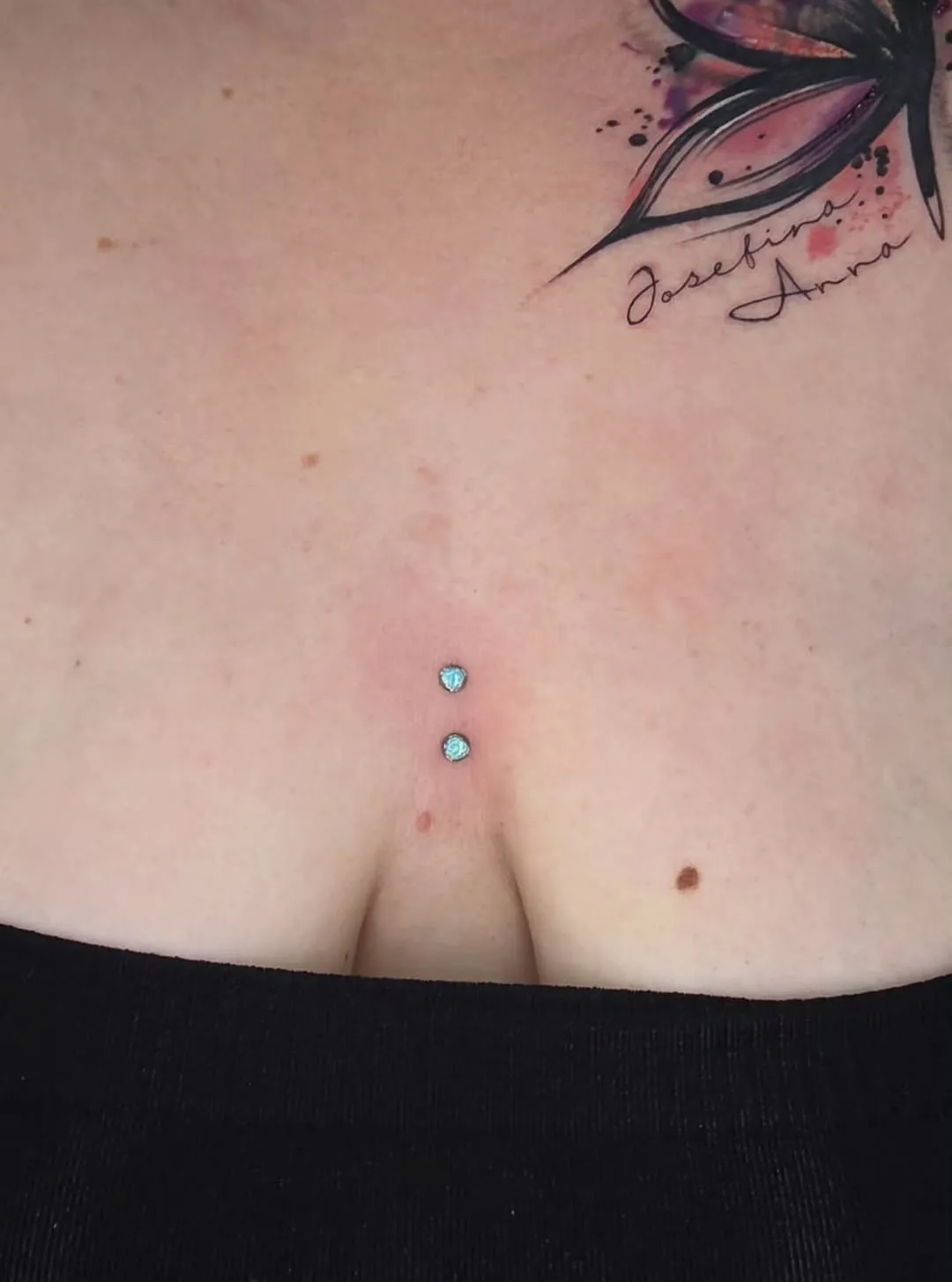Microdermal