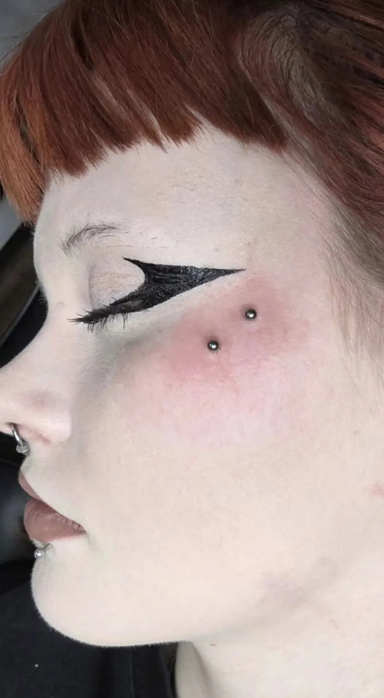 Microdermal na obličeji
